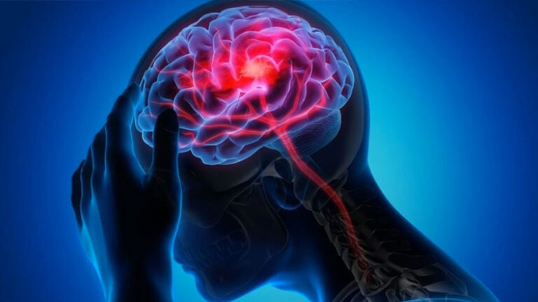 Migrenin Beyinde Neden Olduğu Değişimin Fotoğrafı Paylaşıldı